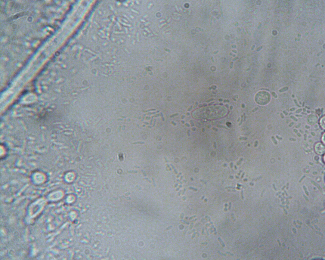 Autoimmune Disease and the Gut Microbiome